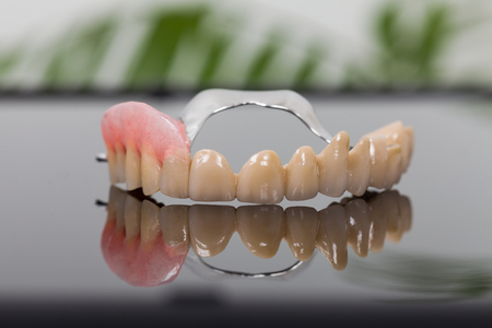 Reduced volume skeletal prosthesis made by dental technician and dentist - low cost but reliable rehabilitation technique.の写真素材