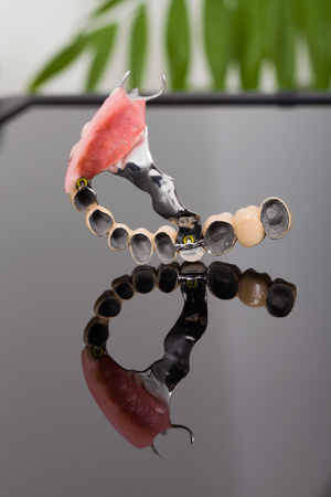Reduced volume skeletal prosthesis made by dental technician and dentist - low cost but reliable rehabilitation technique.の写真素材