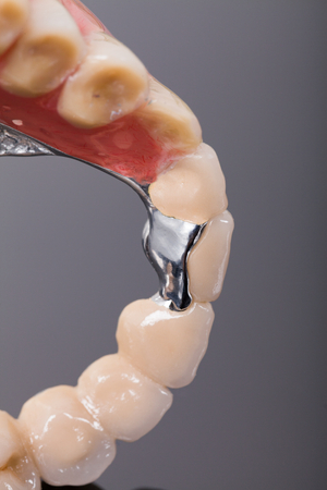 Dental skeletal prosthesis detail made by dentist and technician with special anchoring systems.の写真素材