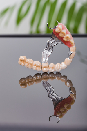 Dental skeletal prosthesis detail made by dentist and technician with special anchoring systems.の写真素材