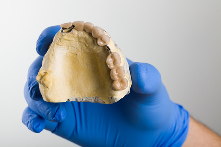 The fix part of a dental skeletal prosthesis on a gypsum casting.の写真素材