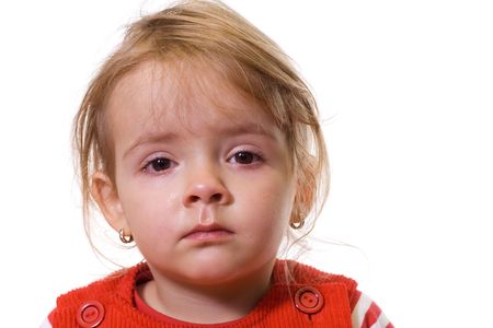 Little girl with a severe flu and red eyes - isolated