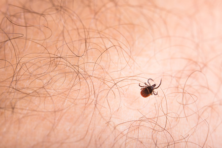 Tick - parasitic arachnid blood-sucking carrier of various diseases