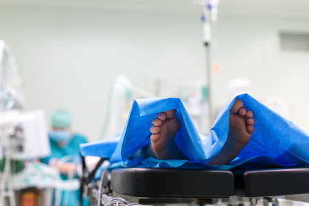 Feet of a patient ready  for a surgery in a surgery room の写真素材