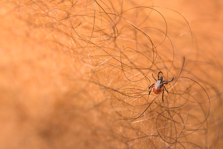Tick - parasitic arachnid blood-sucking carrier of various diseasesの写真素材