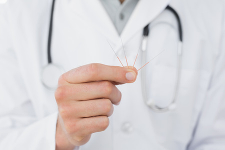 Extreme close-up mid section of a male doctor holding acupuncture needlesの写真素材
