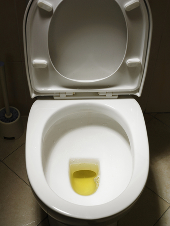 Dirty toilet bowlの写真素材