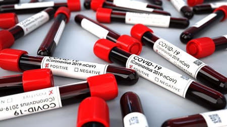 Positive corona test tubes. 3d illustration.