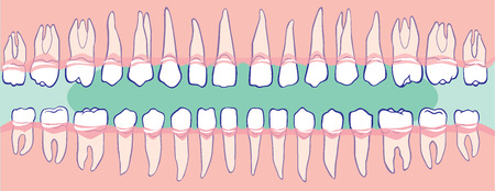 The upper and lower teeth, the human jawのイラスト素材