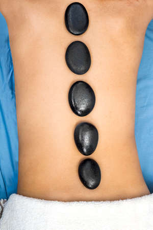 back massage with volcanic hot stones on blue backgroundの写真素材