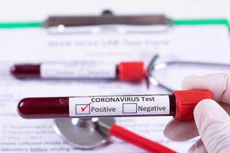 Close-up woman hand holding the test tube with blood sample for COVID-19 test. Coronavirus or...