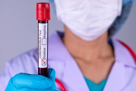 Positive COVID-19 test and laboratory sample of blood testing for diagnosis Corona virus infection....