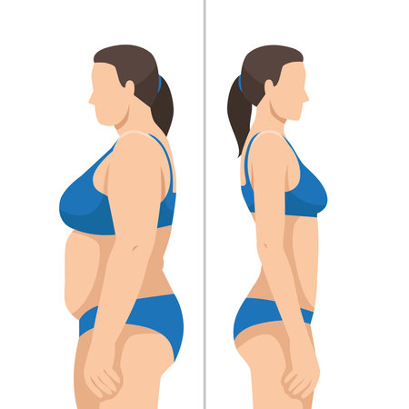 Illustration of a visual comparison of a woman's body before and after weight loss progress. Flat vector illustration isolated on white backgroundのイラスト素材