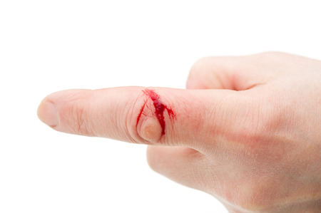 Flesh wound with  blood on male  finger の写真素材