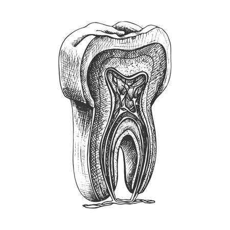 tooth structure, graphics, vector contour illustration on a white background, molar, gum, root, vessels, nerves, incision, anatomical drawing, black sketchのイラスト素材