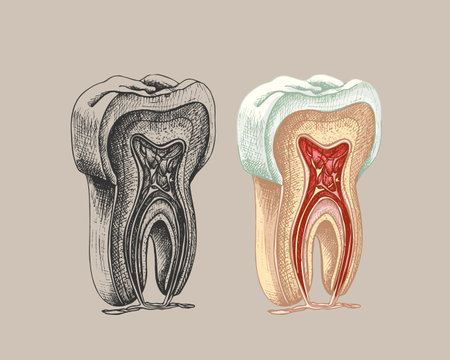 tooth structure, graphics, vector contour illustration on a white background, molar, gum, root, vessels, nerves, incision, anatomical drawing, colored, black sketchのイラスト素材