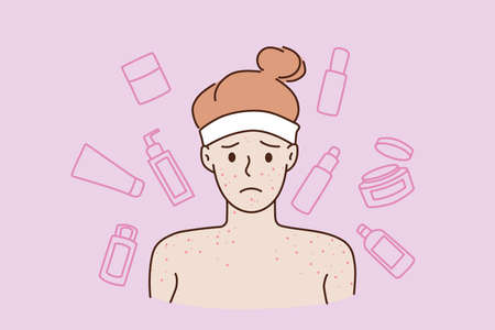Skin problems and skincare concept. Face of young stressed sad teen boy standing with naked shoulders having red acne or pimples vector illustrationのイラスト素材