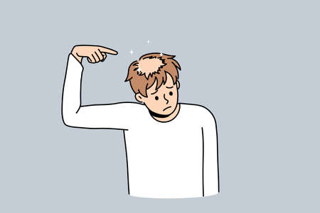 Unhappy young man point at bald head suffer from alopecia problems. Upset stressed guy struggle with hair loss need medical treatment. Haircare and aging concept. Flat vector illustration.のイラスト素材