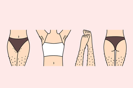 Hairy female legs and thighs in need of depilation or epilation using wax tape and sugaringのイラスト素材