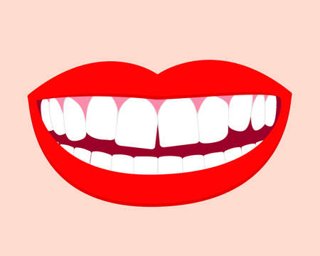 Smile mouth with crooked teeth. Vector isolated elements EPS10