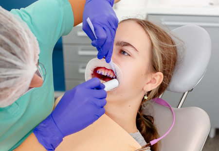 Concept of dental care. The process of installing orthodontic ceramic brackets. Close-up view of dentist's hands applying blue glue to patient's clean bottom teeth before attaching bracesの写真素材