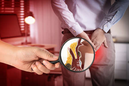Woman showing rectum with hemorrhoids through magnifying glass, closeup. Man suffering from pain...