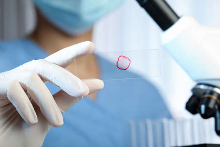Scientist holding microscope slide with red sample in laboratory, closeup
