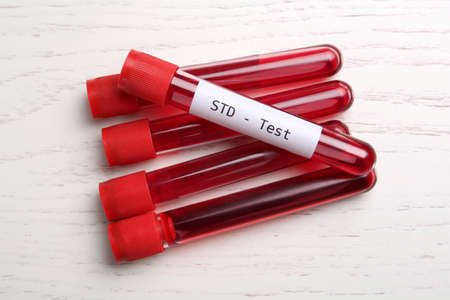 Tubes with blood samples on white wooden table, flat lay. STD test