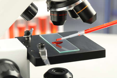 Dripping sample of red liquid onto slide under microscope in laboratory, closeupの写真素材