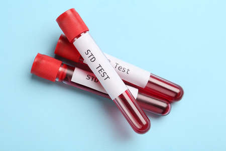 Tubes with blood samples and labels STD Test on light blue background, flat lay