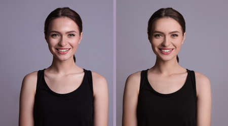Collage with photos of beautiful young woman before and after using mattifying wipes on gray...