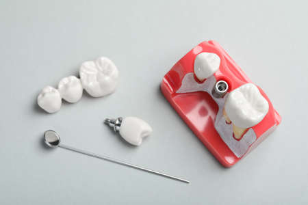 Educational model of gum with post between teeth, dental implant and mirror on gray background,...