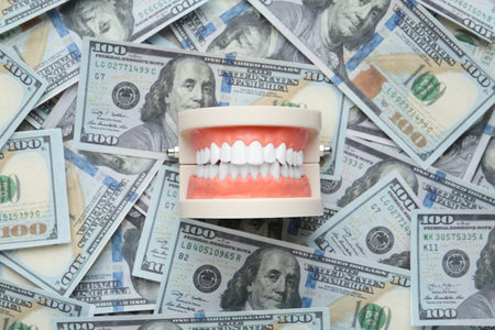Educational dental typodont model on heap of dollar banknotes, top view. Expensive treatmentの写真素材