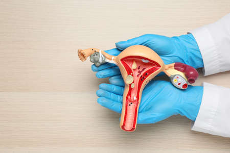 Gynecologist with anatomical model of uterus on wooden table, top view. Space for textの写真素材