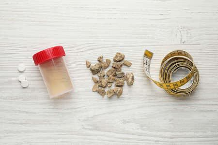 Kidney stones, jar of urine and measuring tape on white wooden table, flat layの写真素材