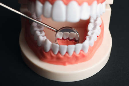 Jaw model and dental mirror on black background, closeup. gum inflammation