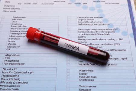 Test tube with blood sample and label Anemia on medical formの写真素材