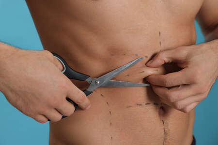 Fit man with scissors and marks on body against light blue background, closeup. weight loss surgeryの写真素材