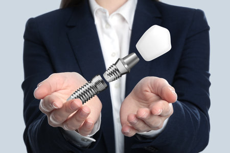 Woman demonstrating dental implant on light background, closeupの写真素材