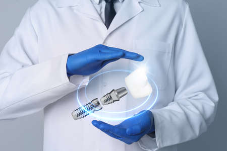 Doctor demonstrating dental implant on light background, closeupの写真素材