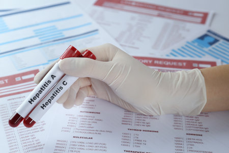 Scientist holding tubes with blood samples for hepatitis virus test against laboratory forms, closeupの写真素材
