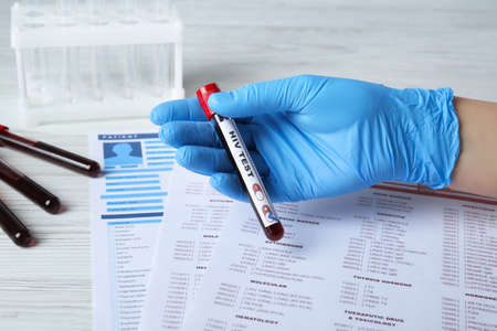 Scientist holding tube with blood sample and label HIV Test near laboratory form, closeupの写真素材