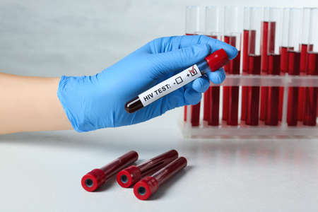 Scientist holding tube with blood sample and label HIV Test at white table, closeup