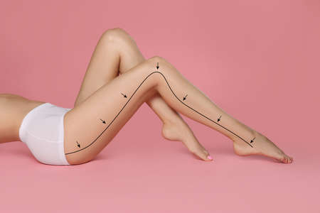 Epilation guide - how to remove hair in proper direction. Woman with drawn lines and arrows on her...