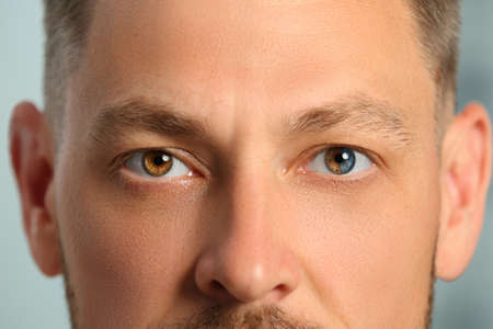 Man with beautiful eyes of different colors, closeup. Heterochromia iridis