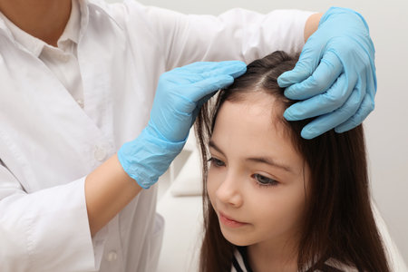 Doctor examining little girl's hair indoors. Anti-lice treatmentの写真素材
