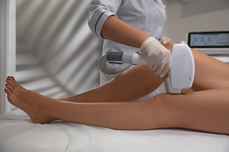Woman undergoing laser epilation procedure in beauty salon, closeupの写真素材