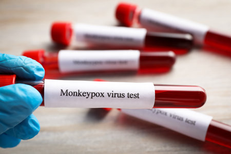 Laboratory worker holding test tube with blood sample over wooden table, closeupの写真素材