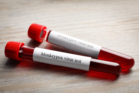 Monkeypox virus test. Sample tubes with blood on wooden tableの写真素材