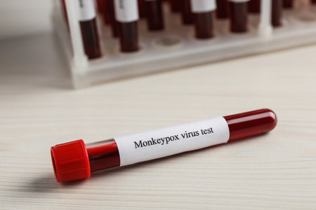 Monkeypox virus test. Sample tube with blood on wooden tableの写真素材